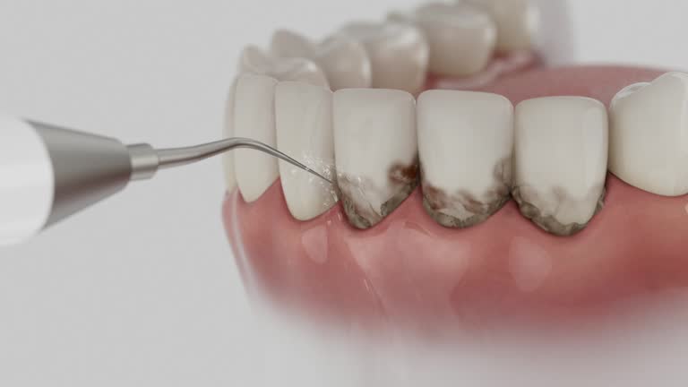 Reliable Dental Implants contractor in Sanger, TX by Smile Center Dentistry